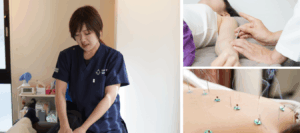 【鍼灸プログラムスタート！】なぜダンサーに鍼灸はオススメなのか？